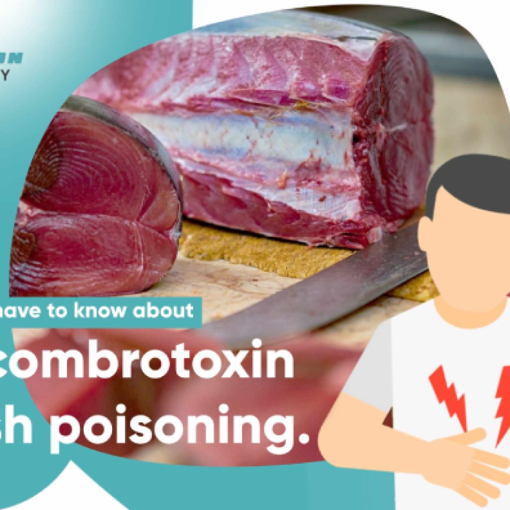 Scombrotoxin Fish Poisoning