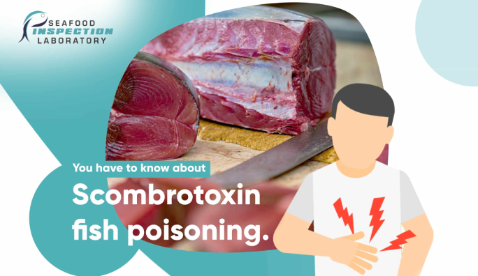 Scombrotoxin Fish Poisoning